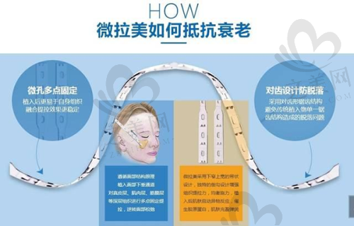 独特技术优势与出色成效