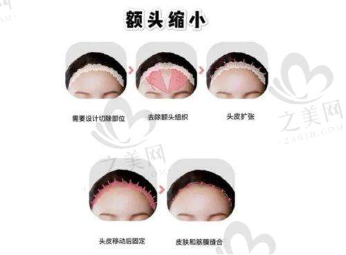 顾客反馈与建议