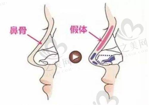 精良设备专精团队
