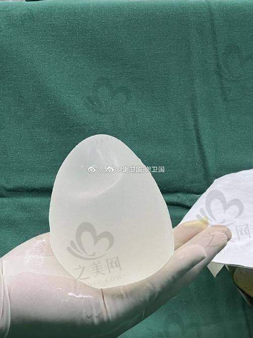 星钻假体优势显著