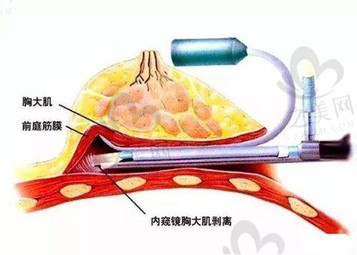 北京嘉禾的傲诺拉璀璨手术，为什么值得选？