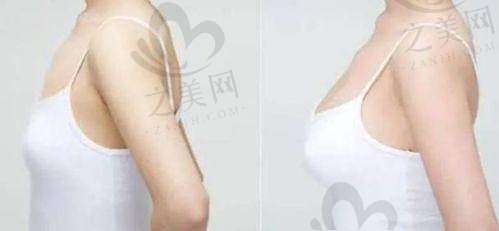 二、根据你的需求选对型号