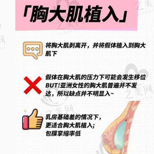 四、为什么选璀璨？三大核心技术解析