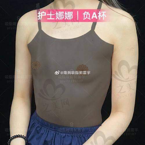 傲诺拉绚耀系列：动感美学代表