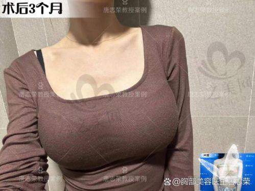 二、星熠系列中凸vs高凸实战对比
