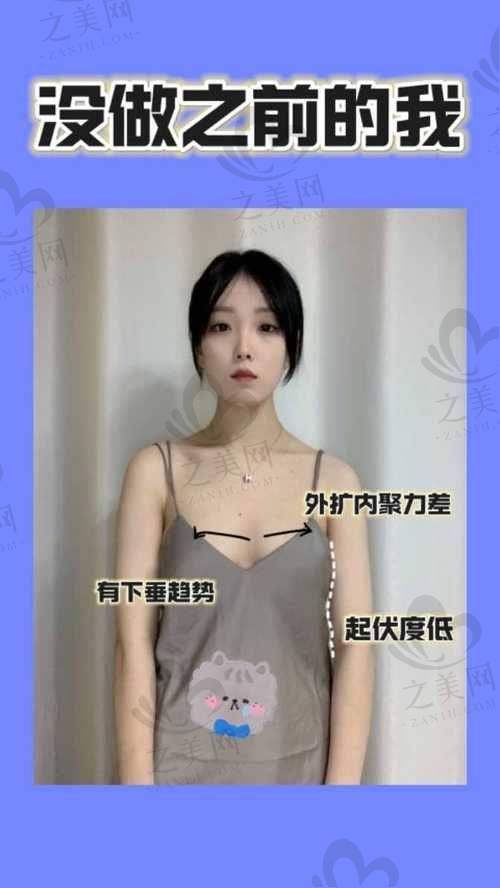 傲诺拉的型号区别有哪些？为你详解闪耀、星熠、璀璨、绚耀系列不同之处