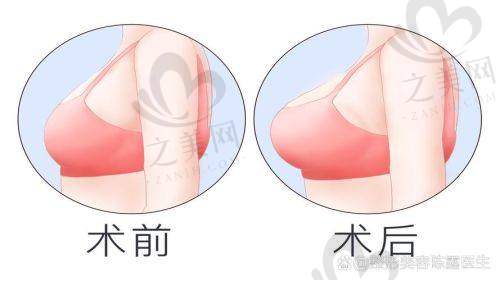 傲诺拉璀璨5大常用型号全解析
