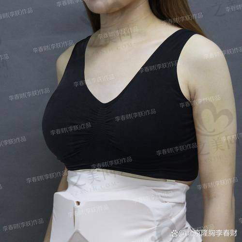 傲诺拉璀璨价格区间