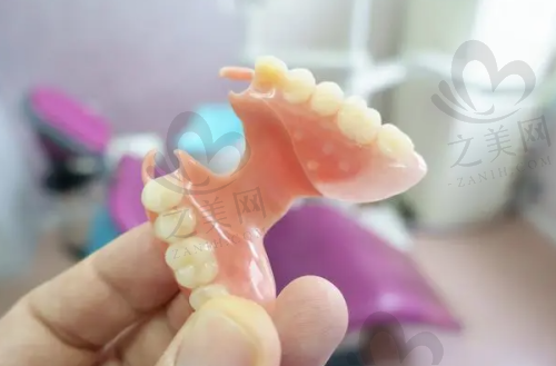 正畸托槽类型