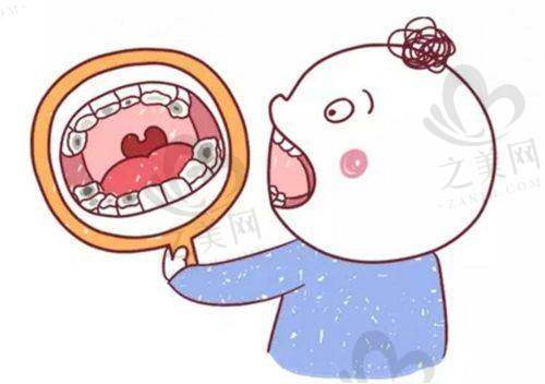 牙龈癌肿块与其他疾病的鉴别