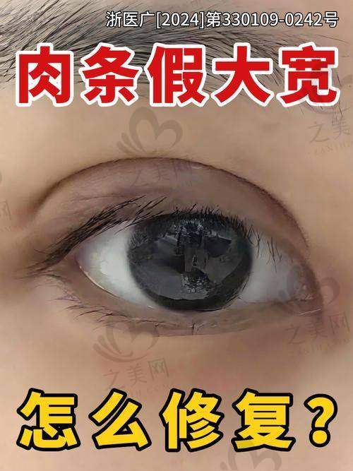 祛斑项目