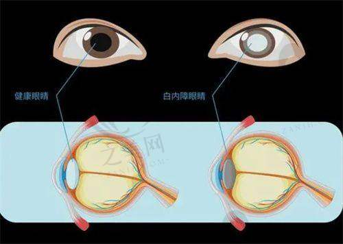 上海医 大眼科吴强：搞科研带学生，他是眼科界的 “高能邻居”