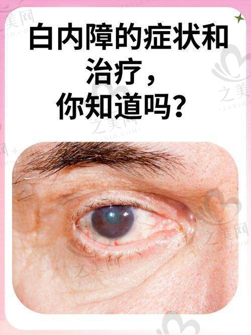 上海医 大眼科吴强：当 “光明邻居”，他要做一辈子