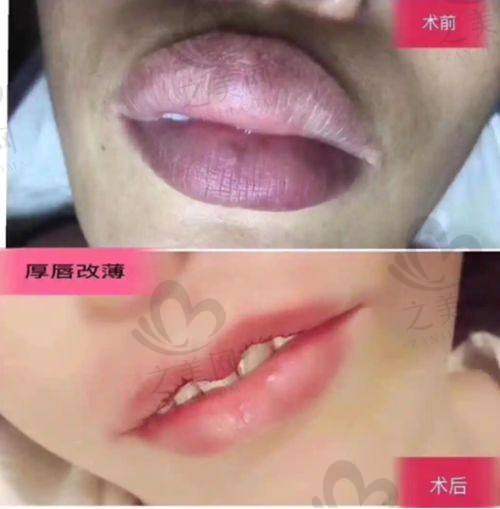 昆明昆大皮肤病(腋臭)医院的美肤魅力