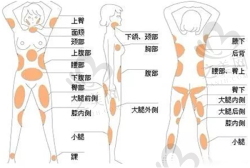 苹果肌提升项目