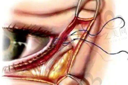 北京黄寺医疗美容诊所下颌修复收费贵吗？该诊所收费合理，技术优、医生强，是高性价比之选 