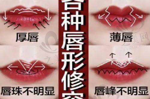 海南艾尚美双眼皮项目价格优势