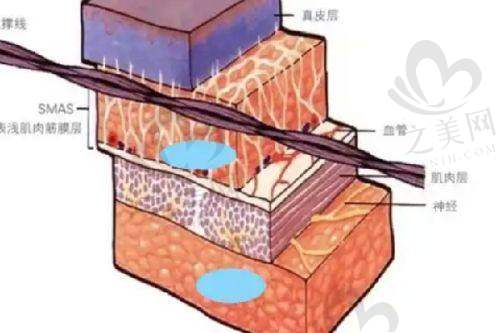 特别优惠项目详情