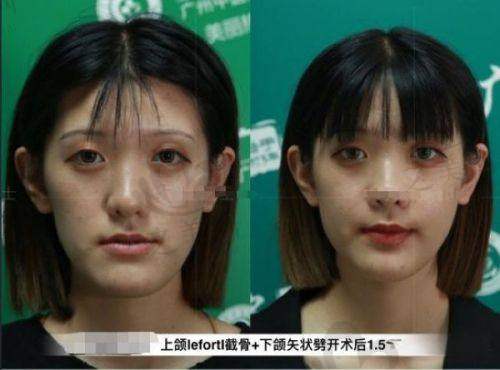 现预约享满减满赠,优惠多多
