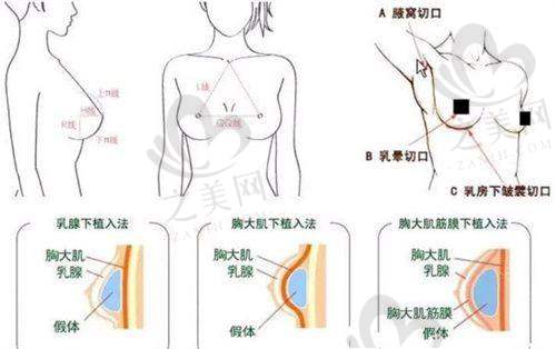 面部整形项目及价格