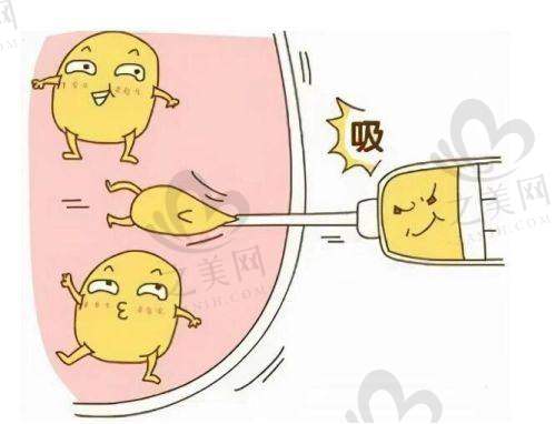 热门项目之去黑眼圈