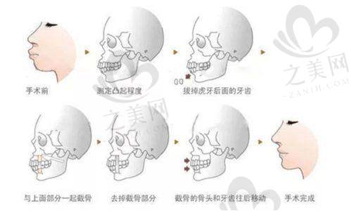 热门项目及价格