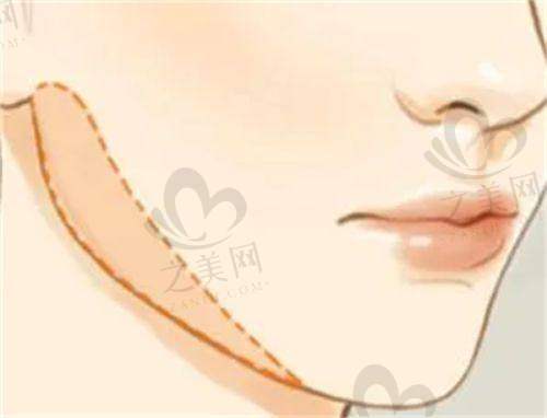 六、避坑指南:选医院前,这3点必须看!