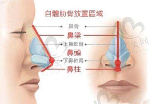 北海美秀中禾美容整形诊所的项目类型