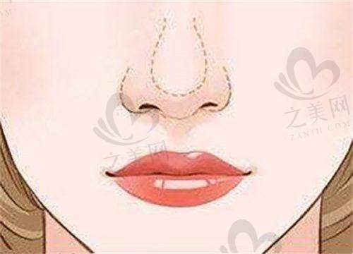 韩国不同皮肤科索夫波成效维持时间情况