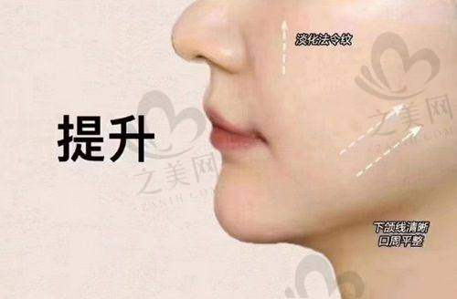 韩国索夫波效果维持时间影响因素全解析,如何延长效果期快来抄答案