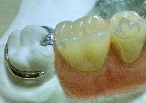 穗华口腔优惠贴心