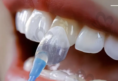 后悔原因之矫正过程中的困扰