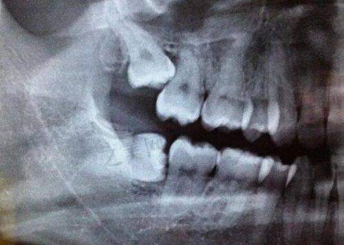 烟台市牟平区中医医院口腔科:骨干医生领衔实力不凡