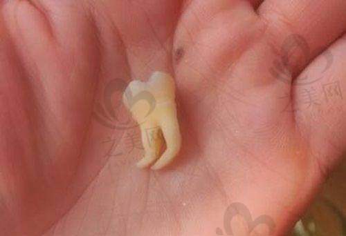 光华口腔挂号较难