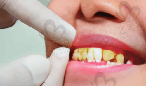 北京中诺口腔医院的良好口碑