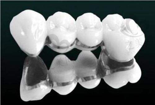 拔牙项目收费合理