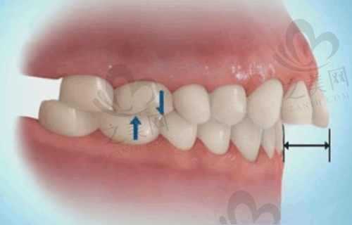长沙牙科收费价目表