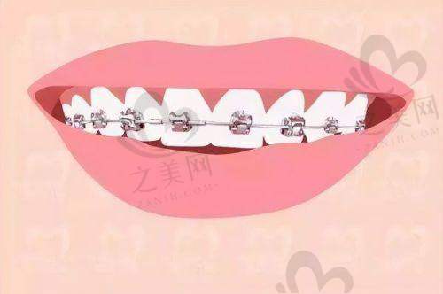 补牙排名前十牙科