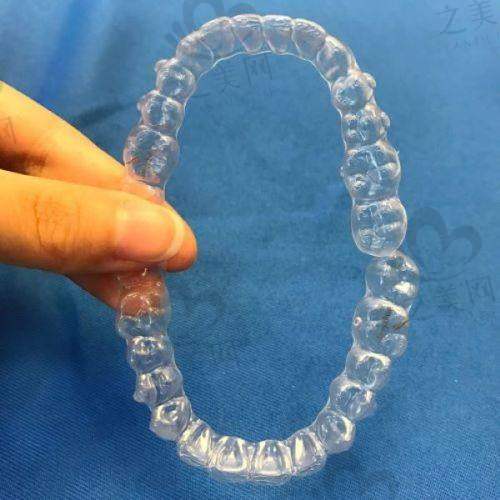 常见疑问解答之嘴突矫正会显老且法令纹更深吗