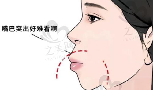 推荐医生助力口腔治疗