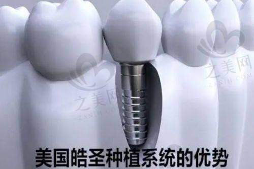 吸附性义齿制作周期短