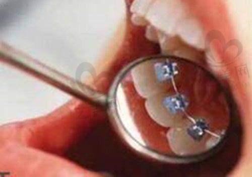 透明收费与优惠政策贴心