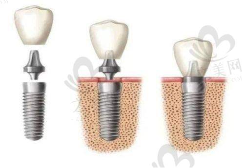 选择口腔机构的综合考量