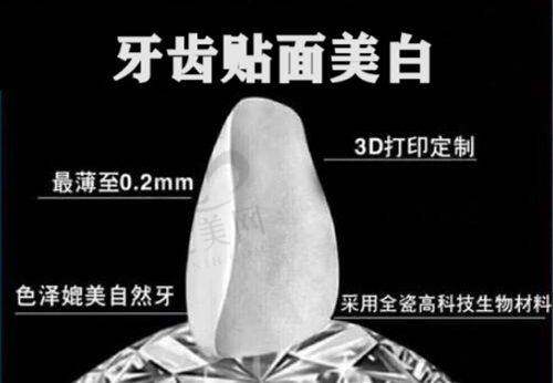 北京中诺口腔医院的特色技术