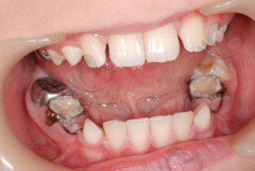 瓦房店第三医院口腔科:专精服务有保护