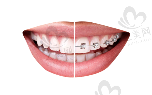 其他看牙项目价格合理