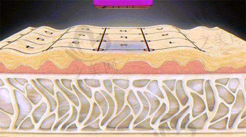 韩国热玛吉全脸价格多少钱一次——总结与建议