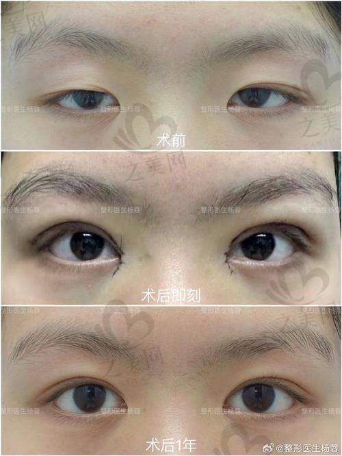 医院排名与有名度