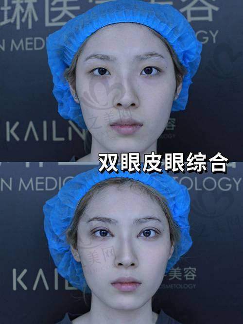 韩国打乔雅登为什么这么便宜呢——质量与性价比考量