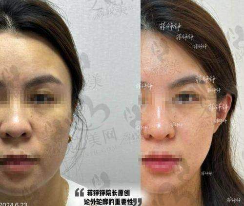 【2025年最新】韩国皮肤管理十大排行榜揭晓！韩国皮肤科优质医院排名及选择建议 